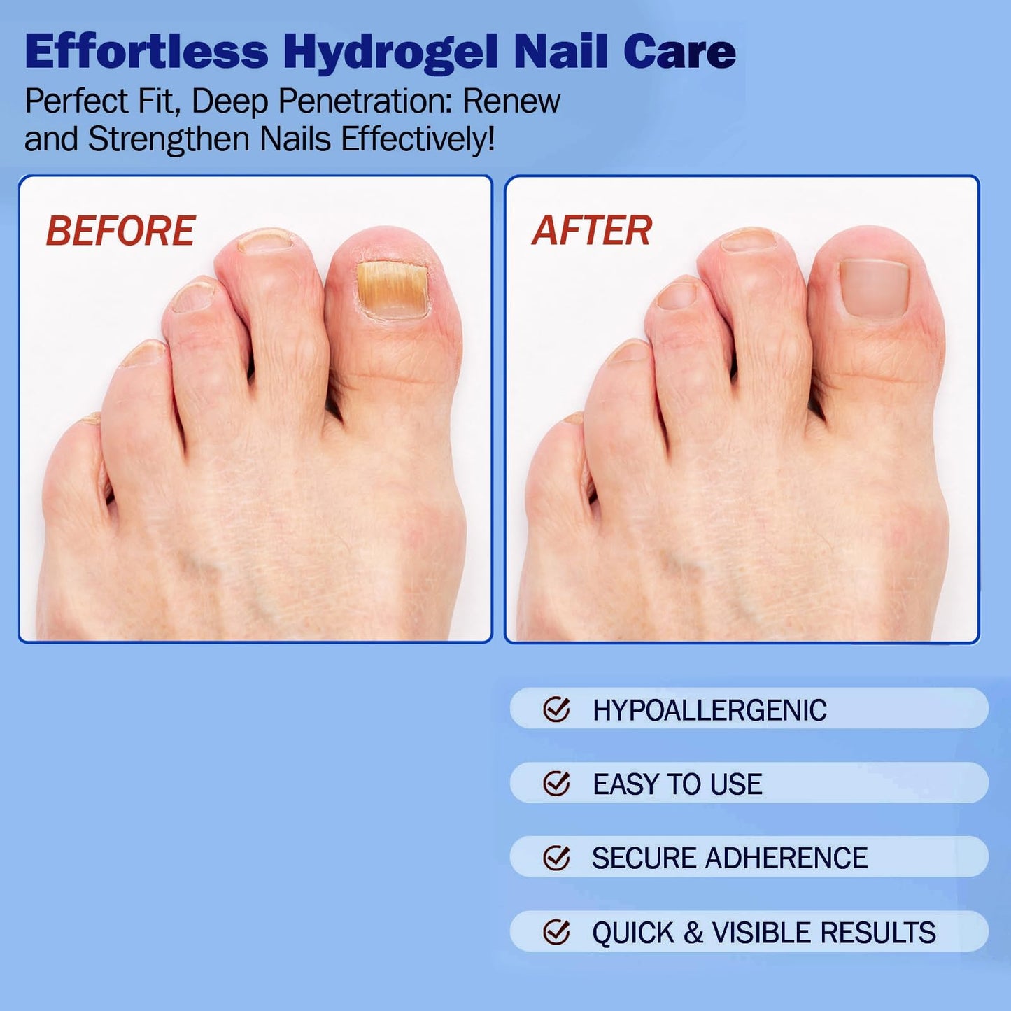 BFGCKJ Fungal Nail Patches for Toenails – 21-Count, Overnight Renewal