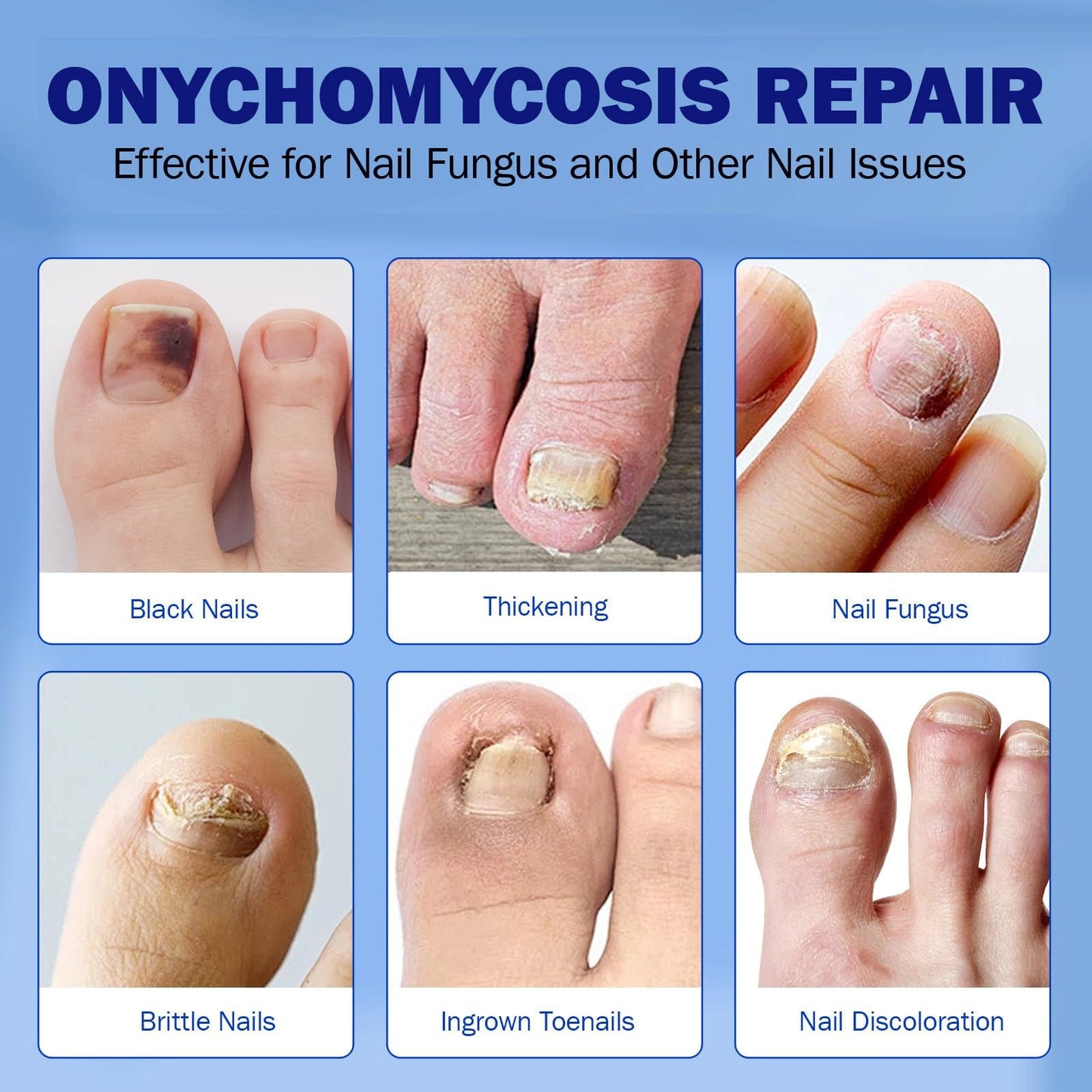 BFGCKJ Fungal Nail Patches for Toenails – 21-Count, Overnight Renewal