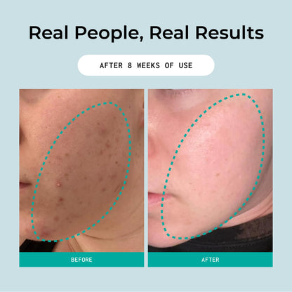 Bigger Than Beauty Skincare Overnight Sensation – Gentle Retexturizing Solution