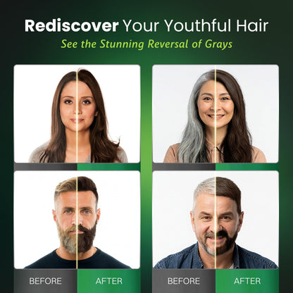 BIOGREEN ROOTS Ammonia-Free Herbal Hair Dye Shampoo for Gray Coverage – Dark Brown (400 ml)