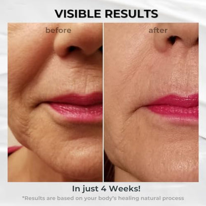 BIONOVA Anti-Aging Upper Lip Treatment with UV Chromophores – Reduce Lip Lines & Prevent Lipstick Bleed (0.5 oz)