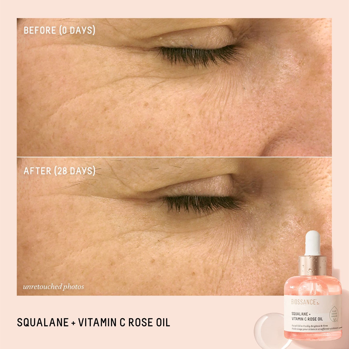 BIOSSANCE Squalane + Vitamin C Rose Advanced Facial Oil – Brightening, Firming & Hydrating Serum for All Skin Types