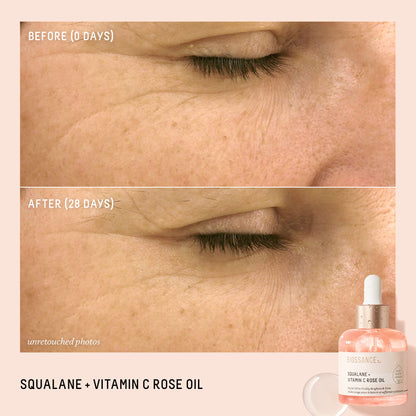 BIOSSANCE Squalane + Vitamin C Rose Advanced Facial Oil – Brightening, Firming & Hydrating Serum for All Skin Types