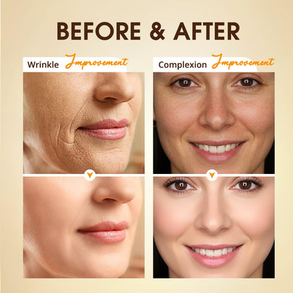 BIYSBER Retinol Collagen Serum for Face – Anti-Aging, Hydration & Firming (1.7 fl oz)
