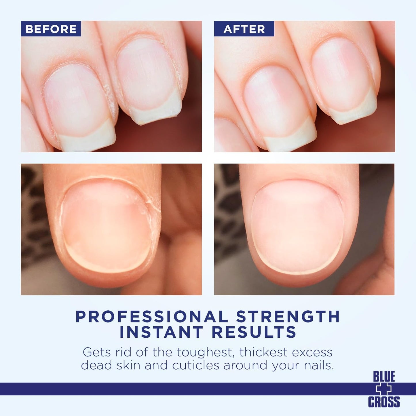 Blue Cross Cuticle Remover & Softener Liquid – Nail Care, 16oz, Made in USA