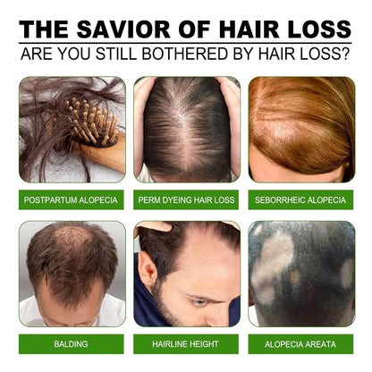 Boaccy Hair Regrowth System – Advanced Hair Growth Treatment with Ginseng, Eclipta Prostrata, Peppermint Oil & Ginger Root
