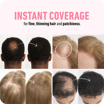Boldify Hair Fibers (2 x 56g) – Instantly Fuller Hair in 14 Shades for Women & Men – Dark Brown