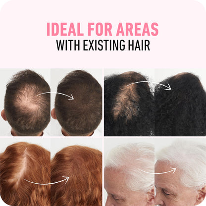Boldify Hair Fibers (2x56g) – Instant Fuller Look for Thinning Hair (14 Shades) – Black