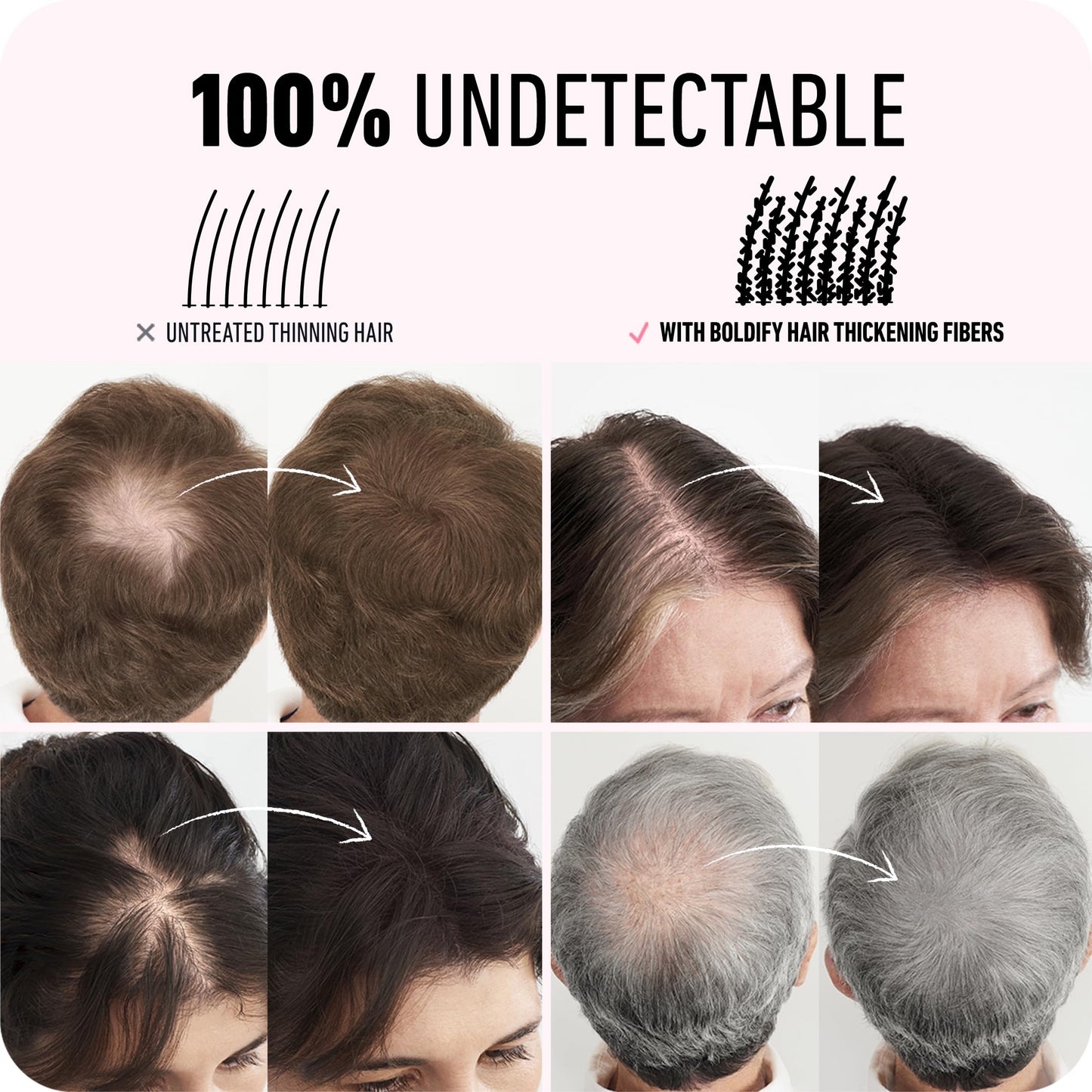 Boldify Hair Fibers (2x56g) – Instant Fuller Look for Thinning Hair (14 Shades) – Black