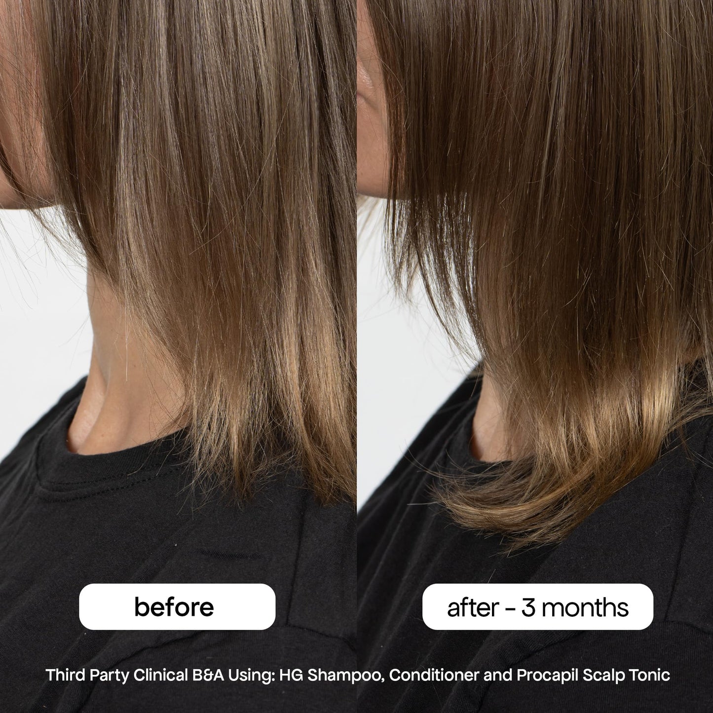 BONDIBOOST HG Anti-Thinning Shampoo – Fuller-Looking Hair, Mint Scent