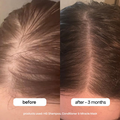 BONDIBOOST HG Anti-Thinning Shampoo – Fuller-Looking Hair, Mint Scent