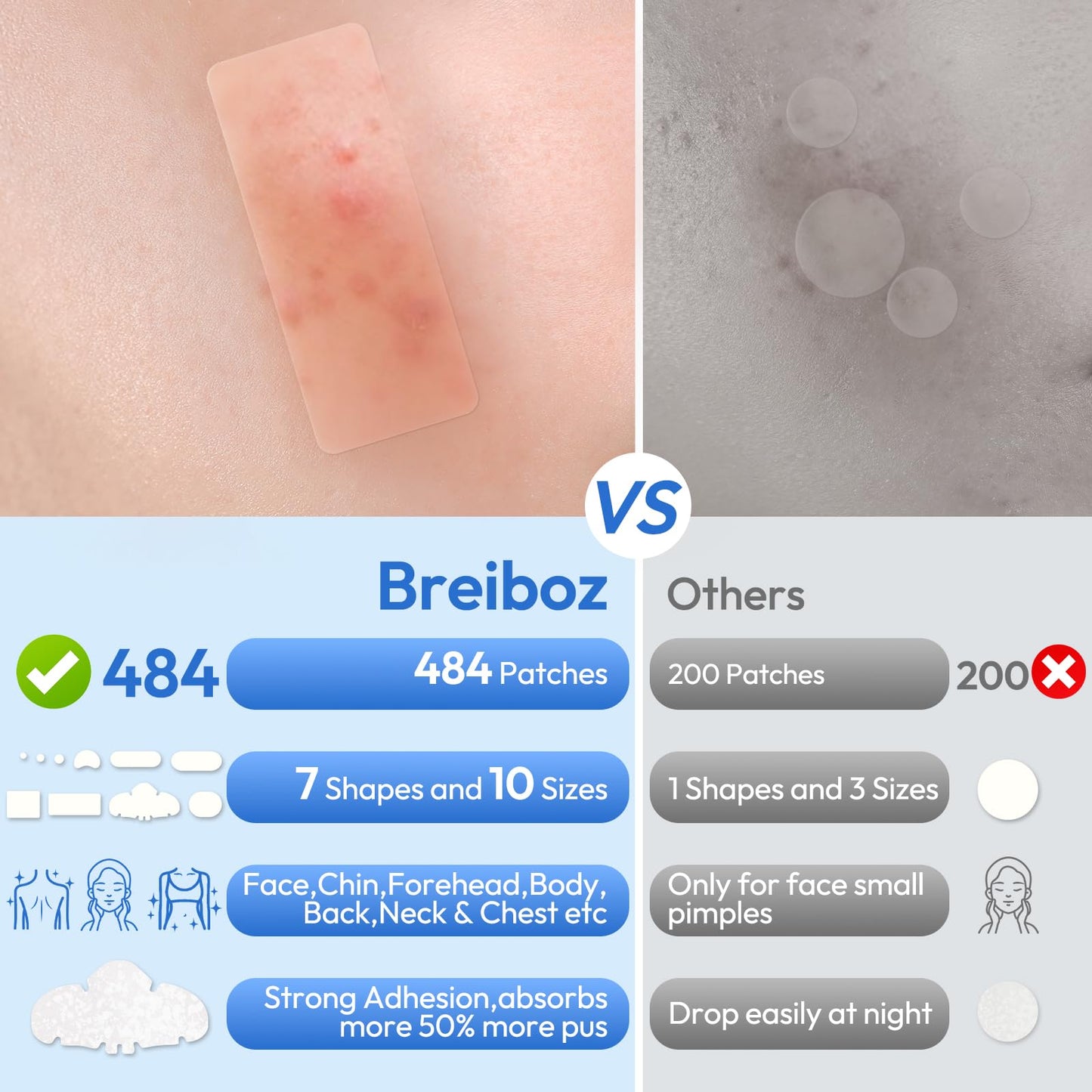 Breiboz Large Pimple Patches – 484 XL Hydrocolloid Patches for Face & Body with Tea Tree, Salicylic Acid & Cica Oil