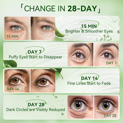 BREYLEE Aloe Vera Eye Masks – 60 Pcs for Puffy Eyes & Dark Circles