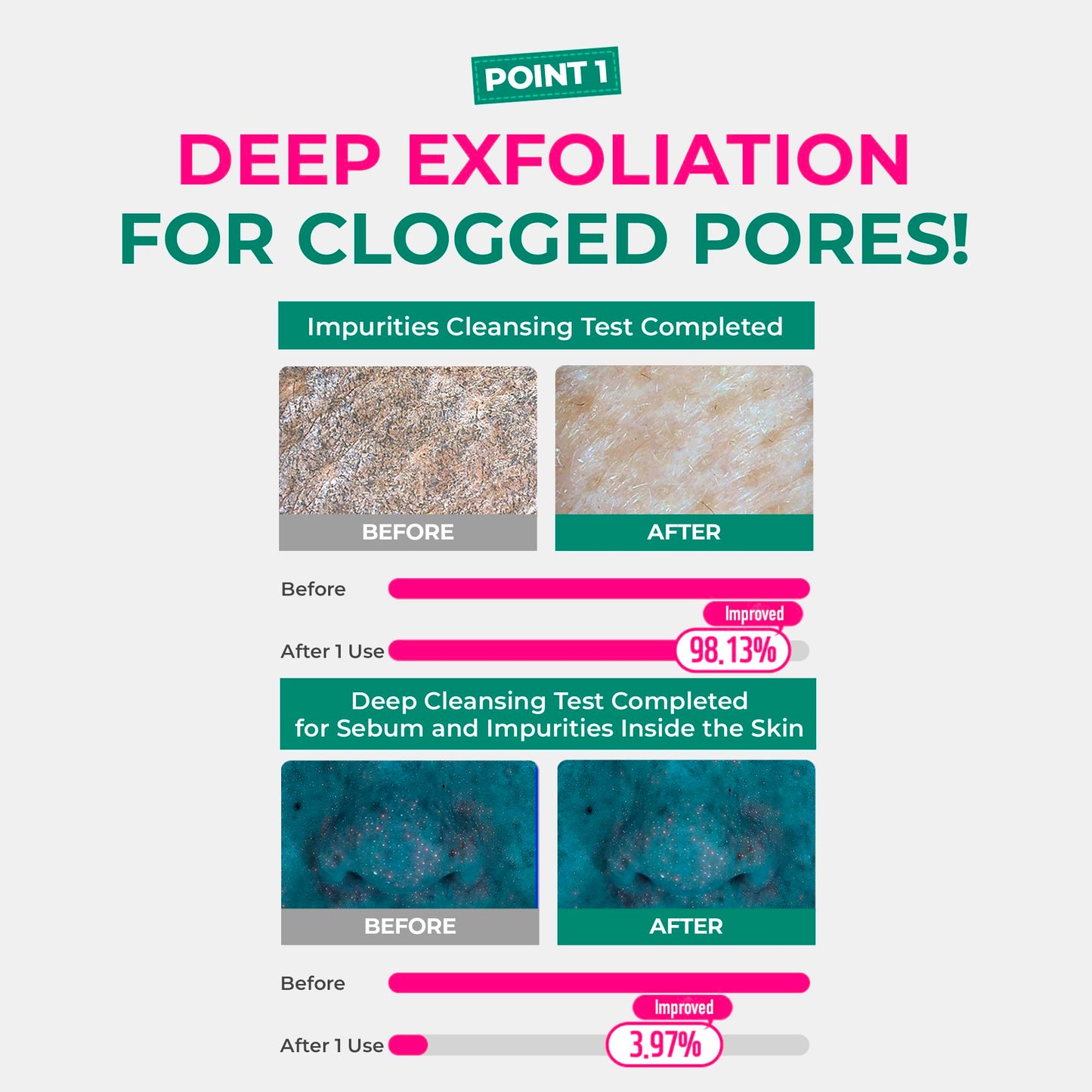 BRING GREEN Netflix Squid Game Edition Tea Tree Cica Pore Clay Pack 100g – Deep Cleansing & Cooling Mask