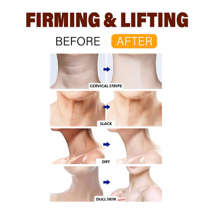 BYMOLIA Neck Firming Cream with Roller – Anti-Aging Neck & Chest, Collagen + Hyaluronic Acid