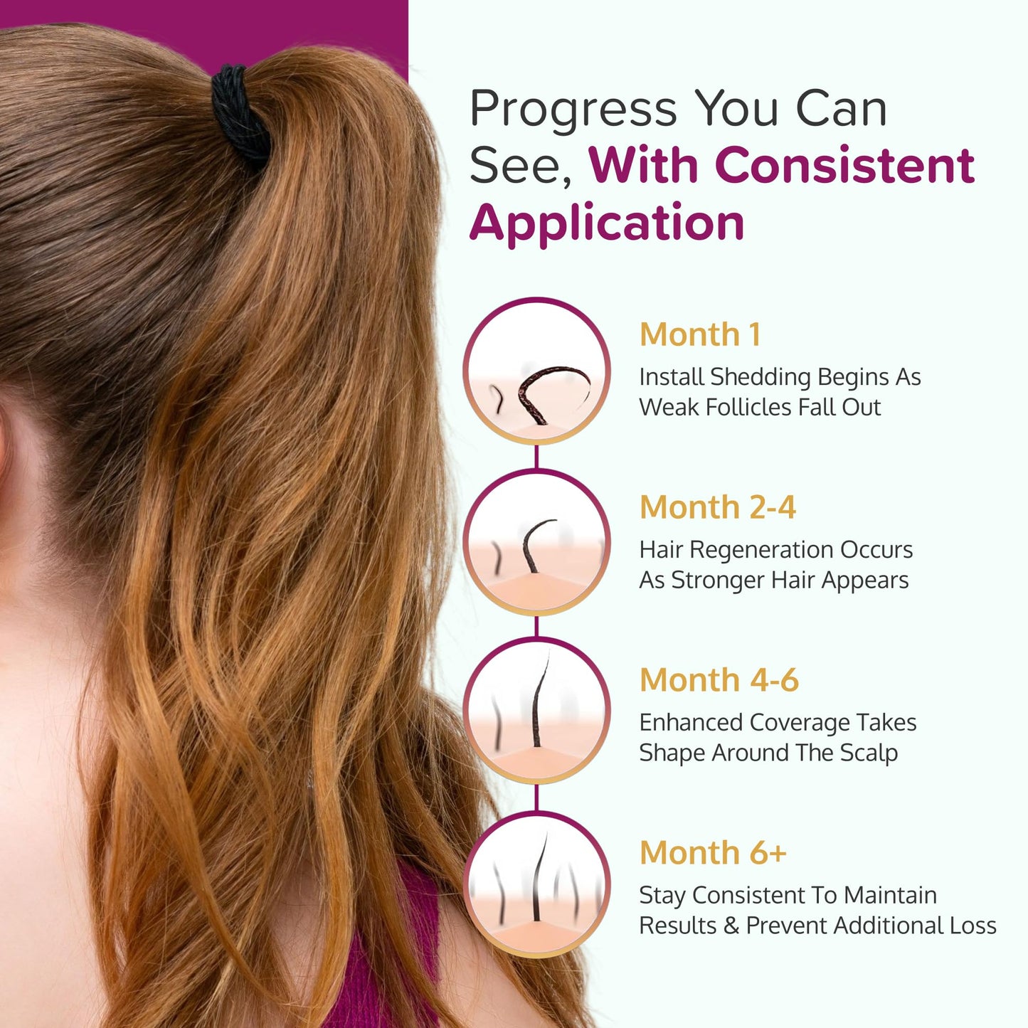 C'rcle 5% Minoxidil Foam for Women — Eight-Month Crown Hair Regrowth