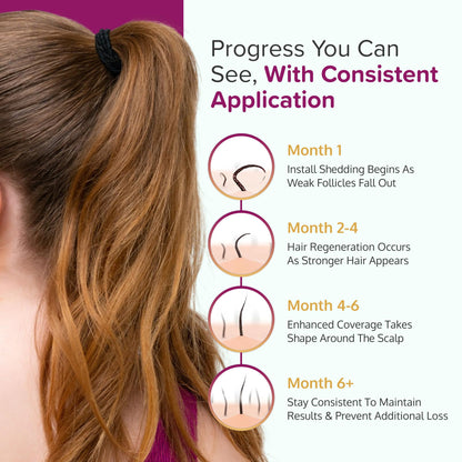 C'rcle 5% Minoxidil Foam for Women — Eight-Month Crown Hair Regrowth