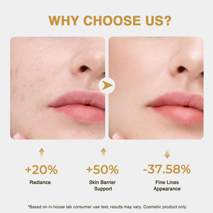 CA CAREL Face Serum – Collagen, Peptides & Niacinamide for Hydration, Brightening & Firming
