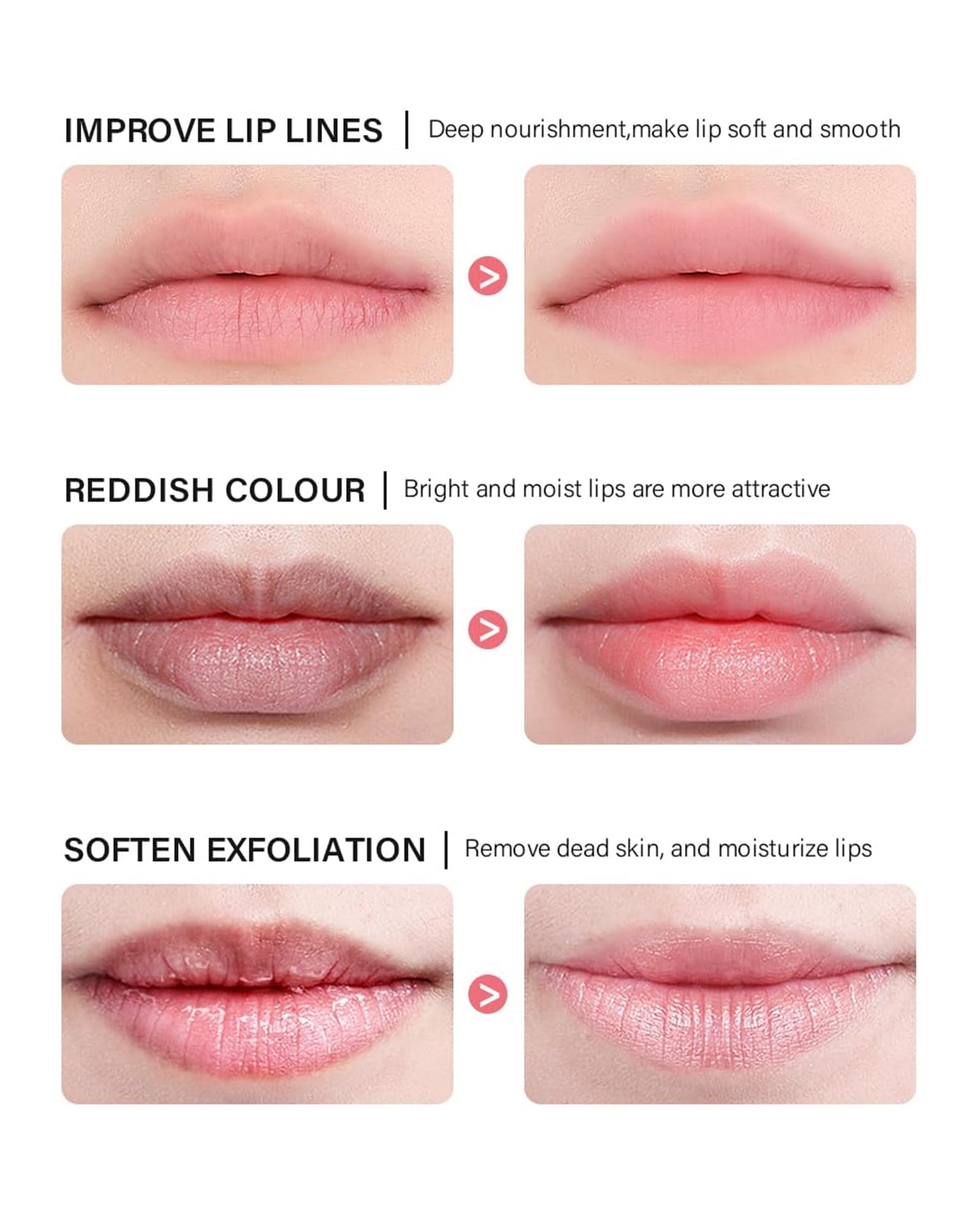 Caedelfly Lip Sleeping Mask Set – 6 Pcs Hydrating Overnight Lip Treatments