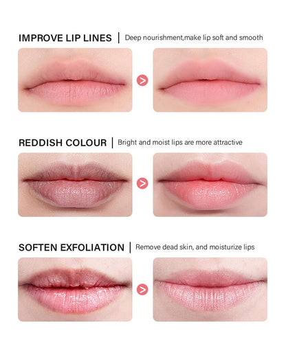 Caedelfly Lip Sleeping Mask Set – 6 Pcs Hydrating Overnight Lip Treatments