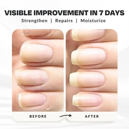CAKE Nail Power Boost: Strengthener with Keratin, Biotin & Vitamin E | Base Coat & Top Coat