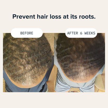 Cardon Hair Growth Conditioner for Men – Niacinamide & Vitamin B5 for a Healthy Scalp