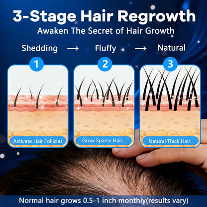 CARENICE 5% Minoxidil Foam for Men with Biotin – Unscented Hair & Beard Growth (6.33 oz)