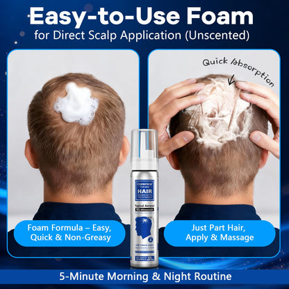 CARENICE 5% Minoxidil Foam for Men with Biotin – Unscented Hair & Beard Growth (6.33 oz)