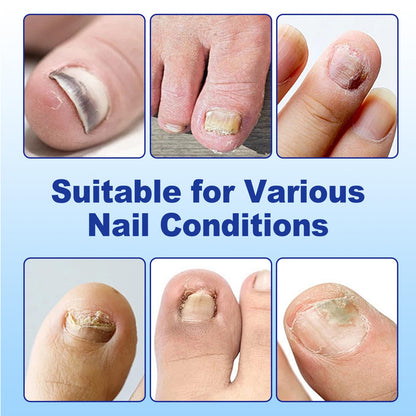 CauseYouLove Nail Patches for Toenails - 2-Pack, 8-Hour Overnight Care, 42 Count