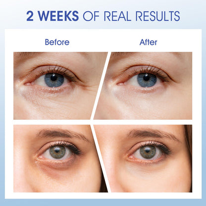 ceedoo Eye Cream for Wrinkles & Fine Lines | Ceramides, Peptides & Caffeine