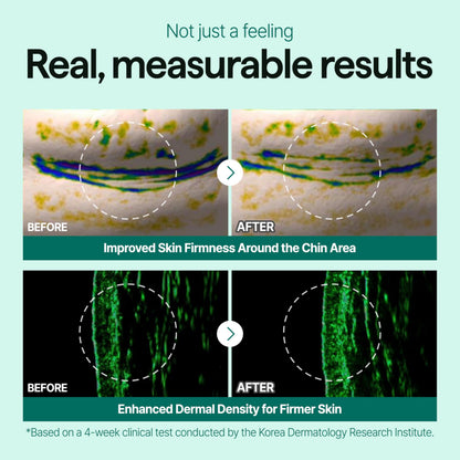CELL IN SHOT Mumak Stem Shot – Skin Lifting & Elasticity Booster with MFSC® Stem Cell Technology