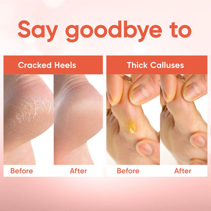 CÉLOR Foot Peel Mask – Baby Soft Feet, Aloe Vera & Lavender, 3 Pairs (Peach)