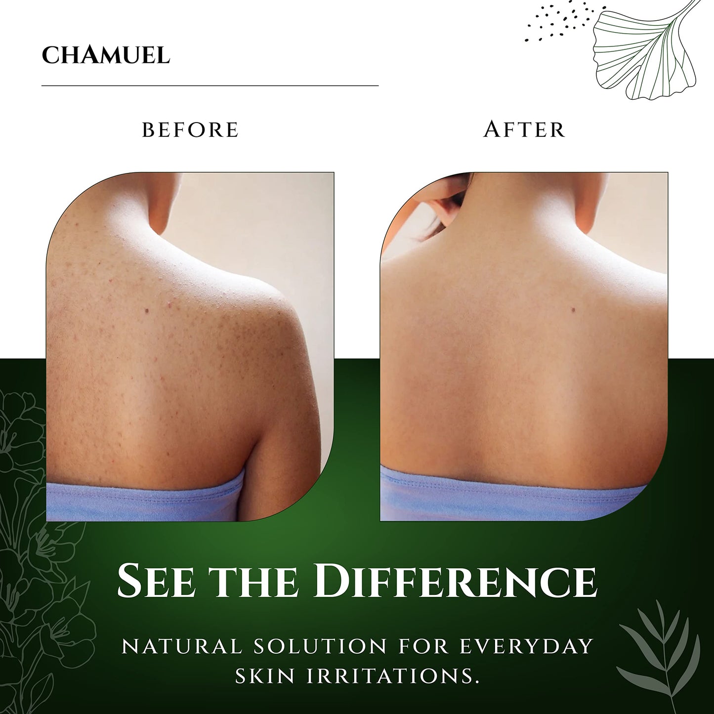 Chamuel Tea Tree Body Wash – 100% Natural, Gentle Cleanse for All Skin Types (11.8 oz)