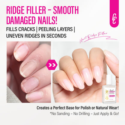 CHUCHU Nail Ridge Filler – 15ml Milky White Nail Strengthener & Growth for Weak Nails
