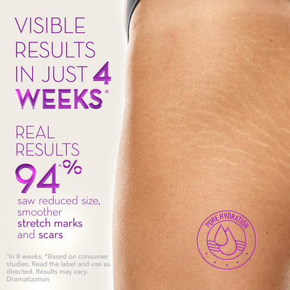 Cicatricure Cica Oil for Stretch Marks & Scars – Fast-Absorbing Body Oil with Vitamin E (6.7 fl oz)