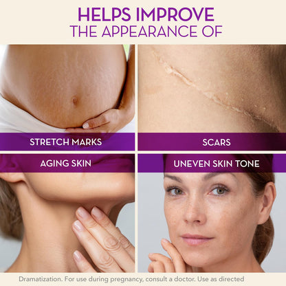 Cicatricure Cica Oil for Stretch Marks & Scars – Fast-Absorbing Body Oil with Vitamin E (6.7 fl oz)