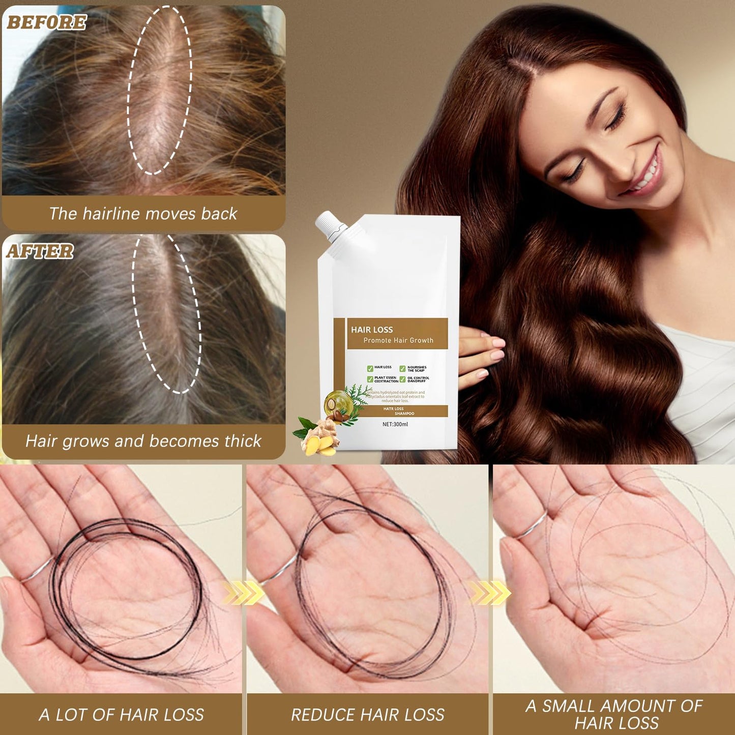 CidnMatd 300ML Anti-Hair Fall Shampoo – Plant-Extract Moisturizing Hair Growth Support for Women & Men