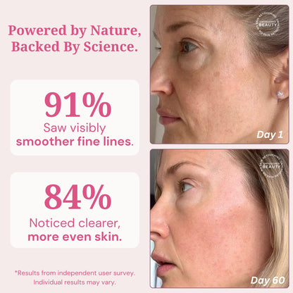 Cinder Brands Vegan PDRN Serum – Vitamin C, Niacinamide & Hyaluronic Acid (1 oz)