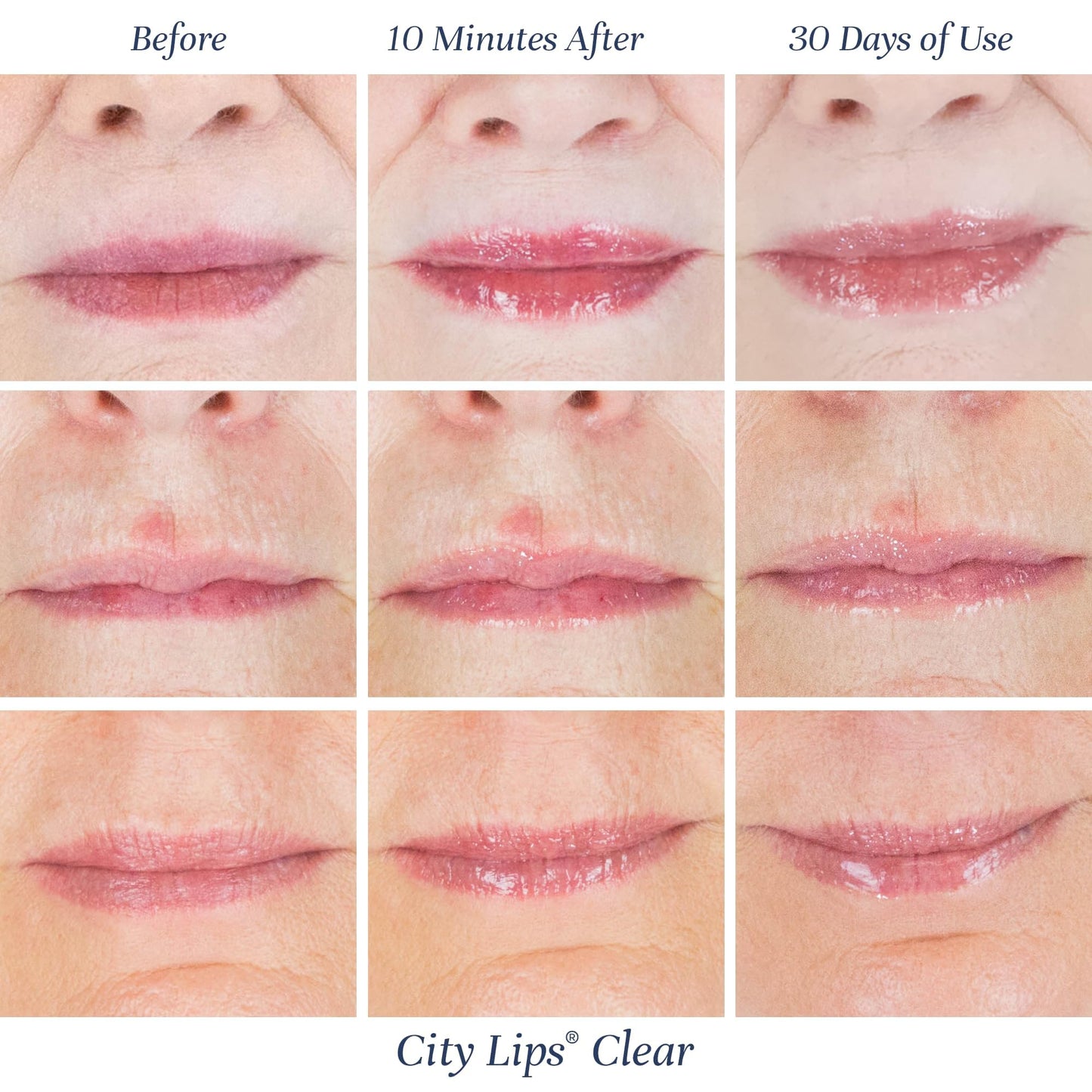 City Lips Clear by City Beauty | Plumping Lip Gloss with Hyaluronic Acid & Peptides (Pack of 3, Cruelty-Free)