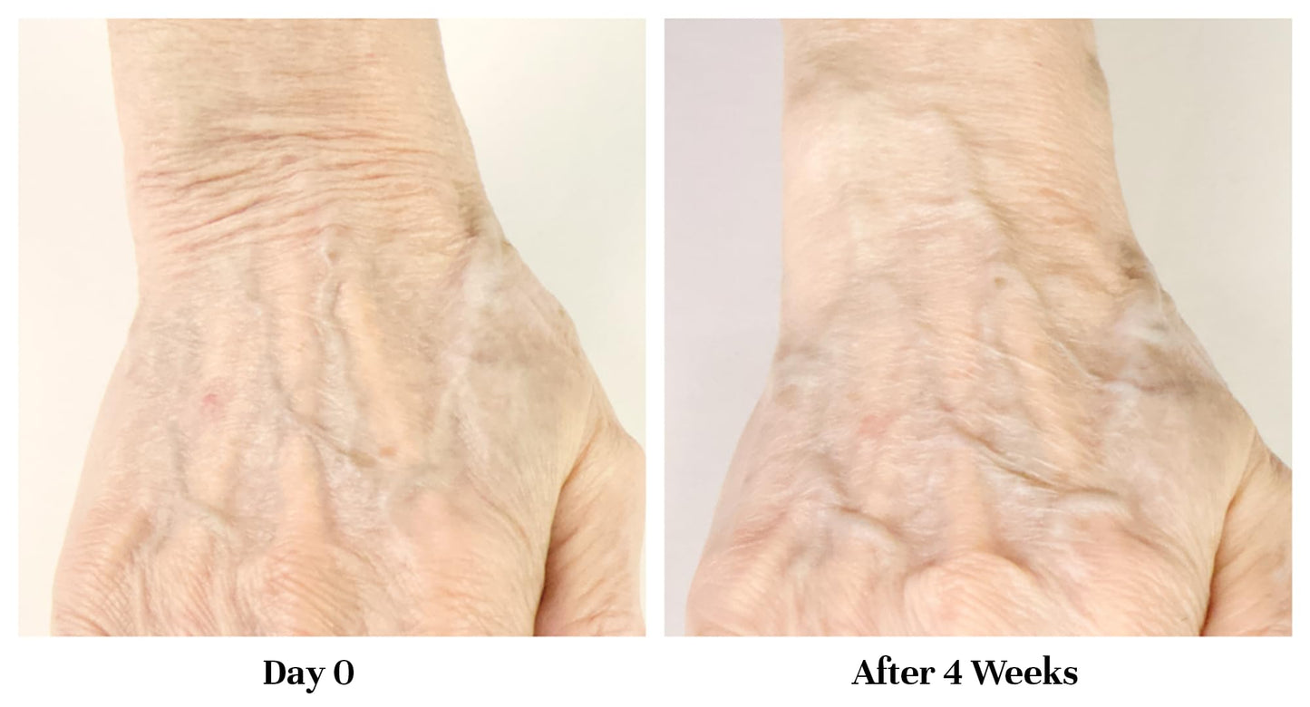 City Beauty Restoring Hand Treatment – Anti-Aging Hand Cream with Wash-Resistant Hydration