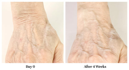 City Beauty Restoring Hand Treatment – Anti-Aging Hand Cream with Wash-Resistant Hydration