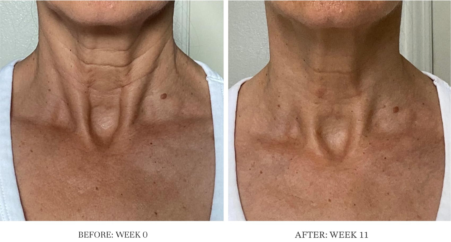 City Beauty Ultra-Firming Dry Oil – Neck & Décolletage Lift & Hydration