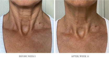 City Beauty Ultra-Firming Dry Oil – Neck & Décolletage Lift & Hydration