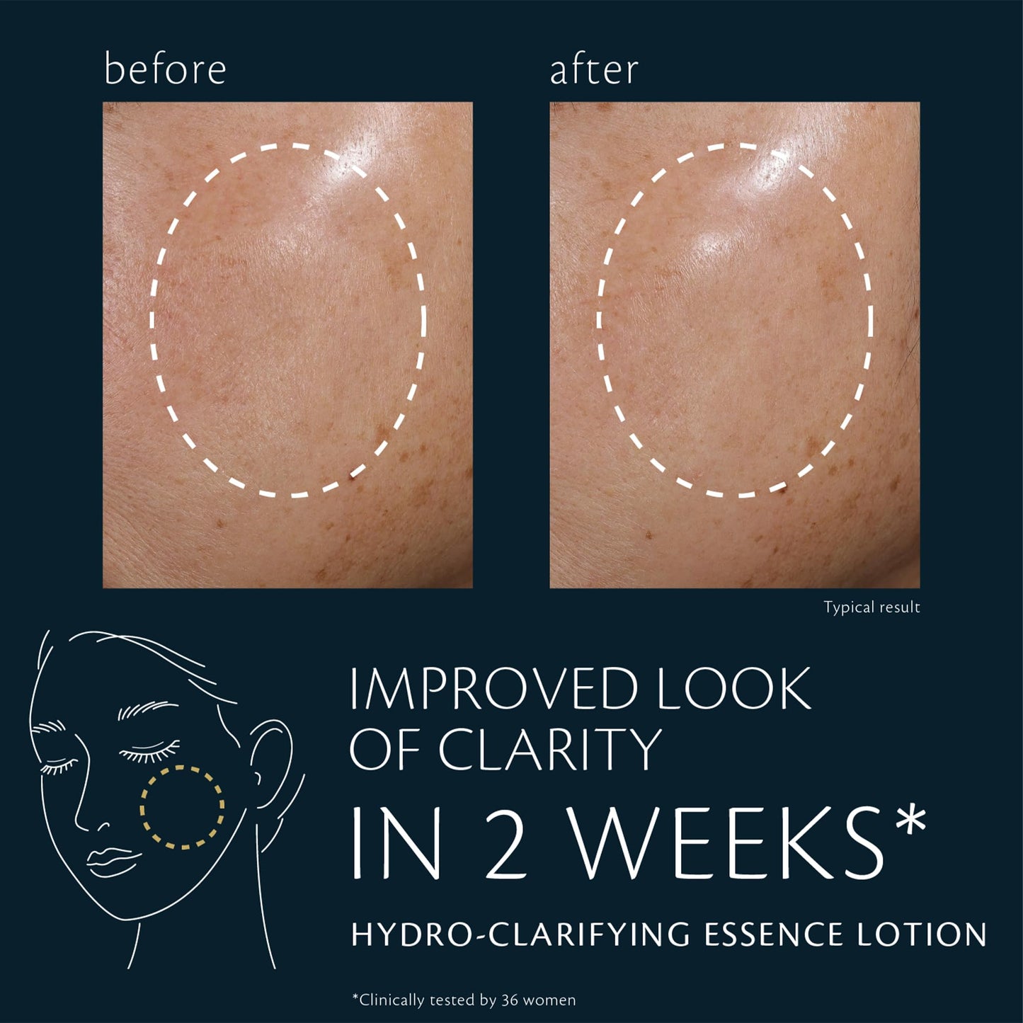 Clé de Peau Beauté Hydro-Clarifying Essence Lotion – Hydration & Refinement for Normal to Oily Skin