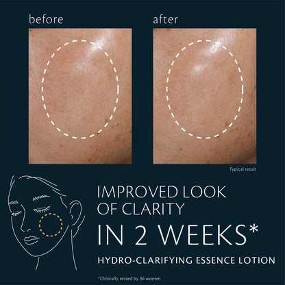 Clé de Peau Beauté Hydro-Clarifying Essence Lotion – Hydration & Refinement for Normal to Oily Skin