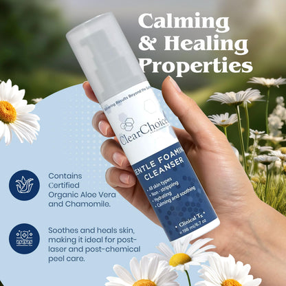 Clear Choice Gentle Foaming Cleanser 6.7oz – Soap-Free, SLS-Free Face Wash for Sensitive Skin