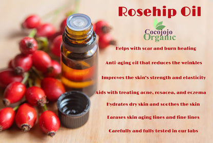 Cocojojo Rosehip Oil – Pure Cold-Pressed Seed Oil, 16 oz (Egypt Origin)