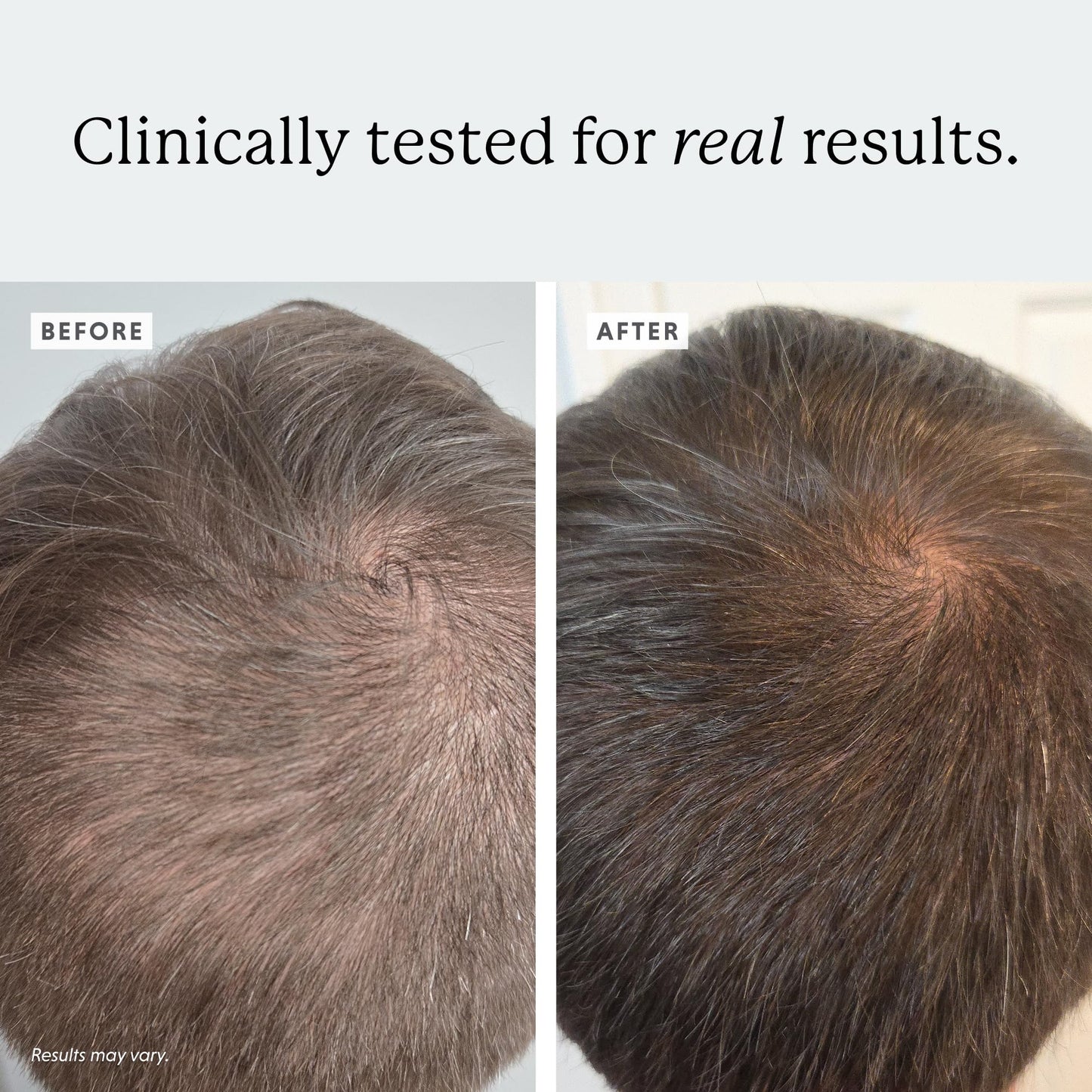 Colorsmith Densifying Scalp Serum – Procapil + Redensyl, 1 fl oz