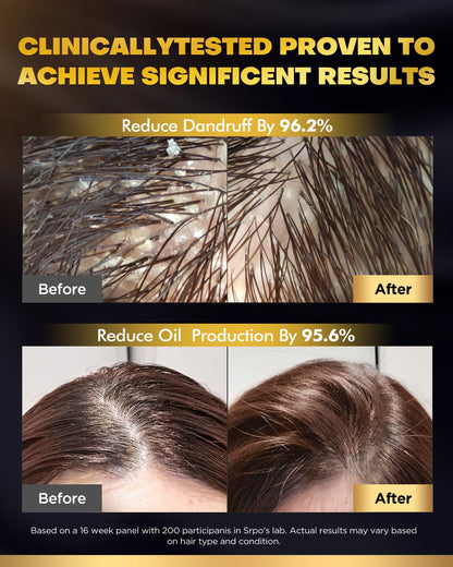 COOLKESI Tripeptide Biotin Hair Growth Shampoo & Conditioner Set – Onion Anti-Loss, Volumizing & Moisturizing Treatment