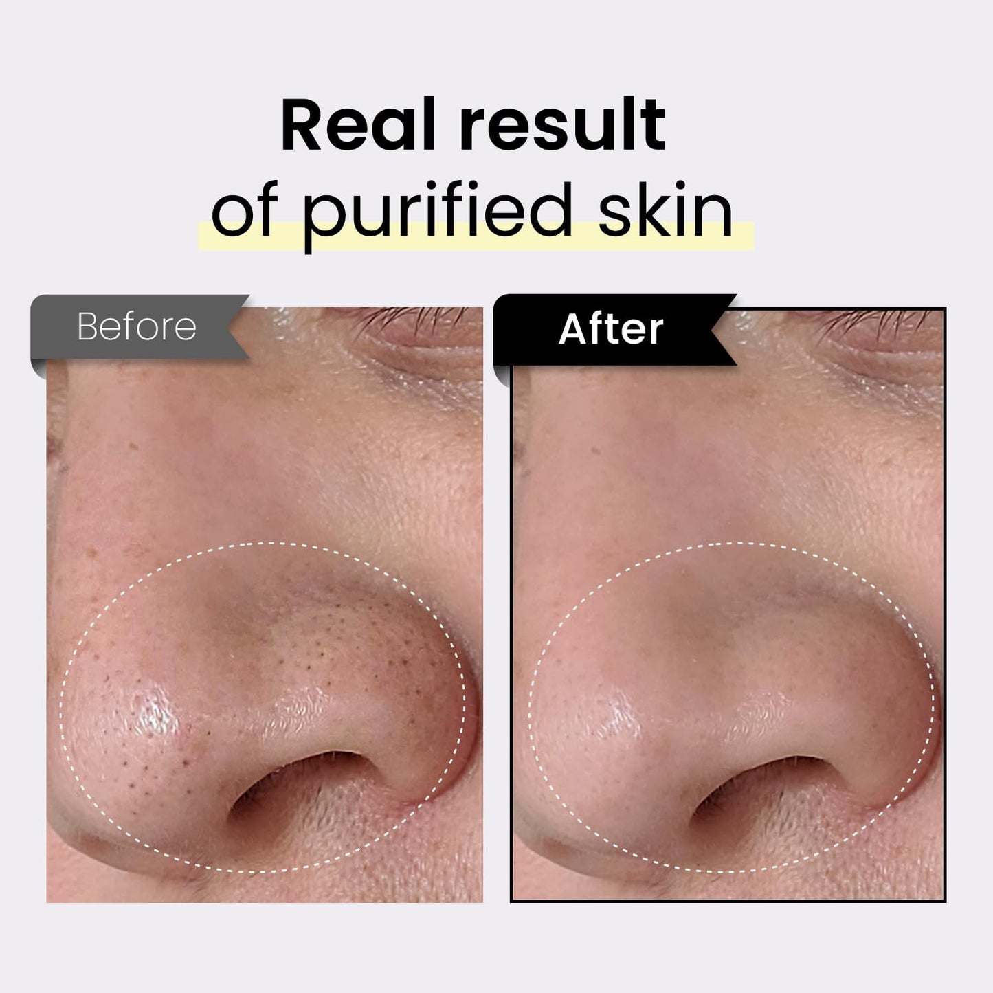 Coxir TXA Black Rice Pore Mask – 3-in-1 Wash-Off Serum for Pore Purification, Hydration & Tone | Vegan K-Beauty 50ml